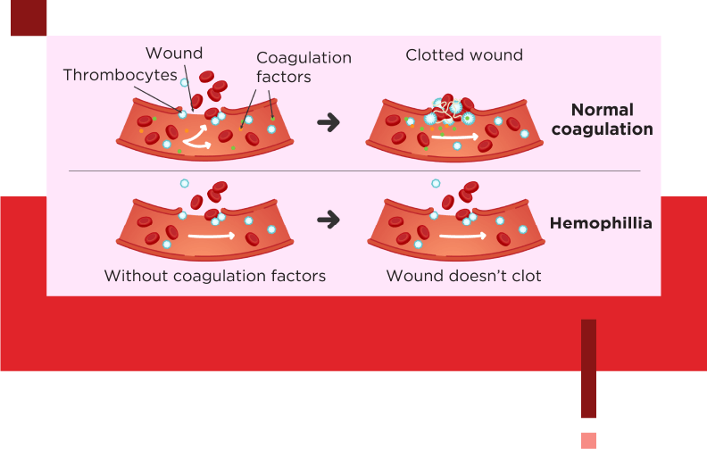 Know Hemophilia